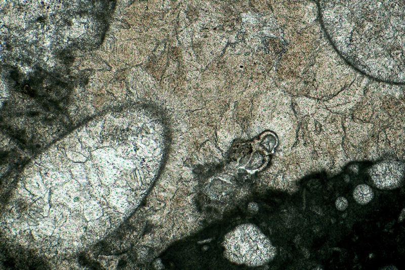 Sesile Foraminifera