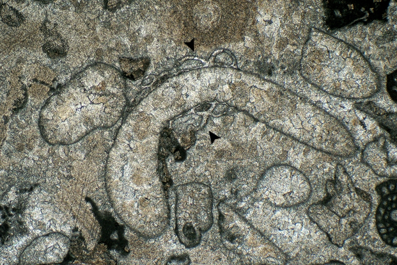 Sesile Foraminifera on Cortoid