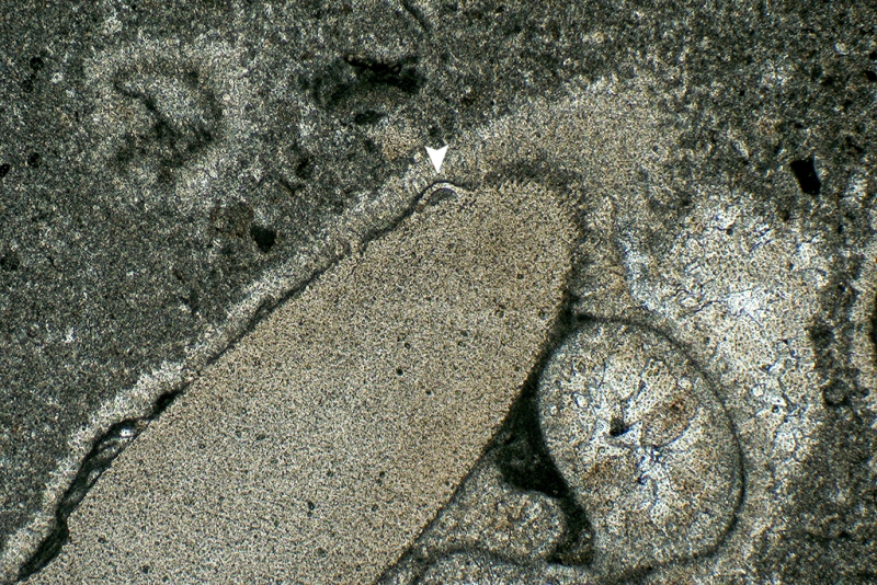 Sesile Foraminifera on Echinoderm