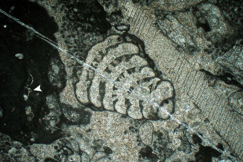 Textularid Foraminifera
